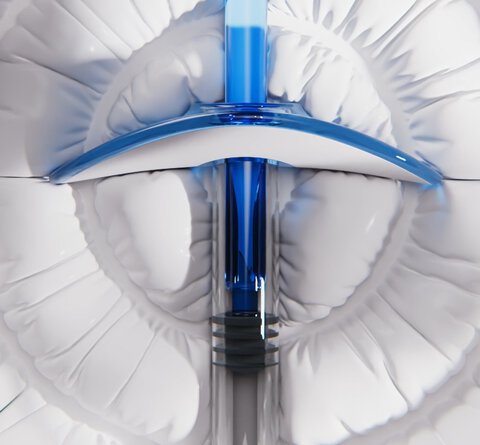 STYLAGE M BI-FLEX LIDO 2x1,0ml